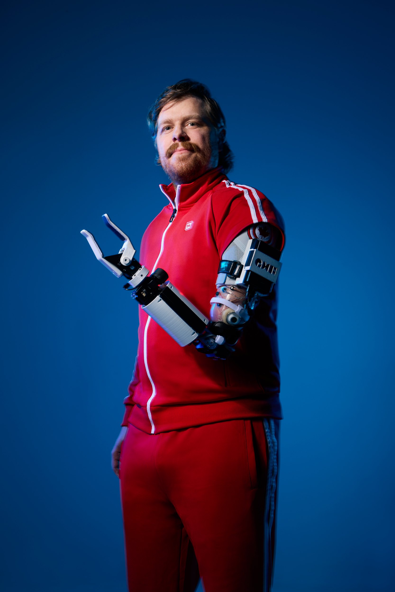 Standing, the prosthetic forearm held out in front of him